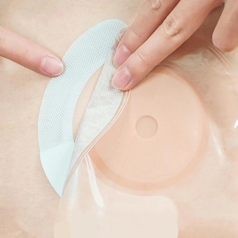 JMOFLUG Elastic Barrier Strips for Colostomy Bags Fixation,20Pcs Hydroentangled Ostomy