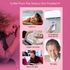 Micro nano Moisturizing Oxygen Sprayer Machine Skin Rejuvenatio Machine Skin