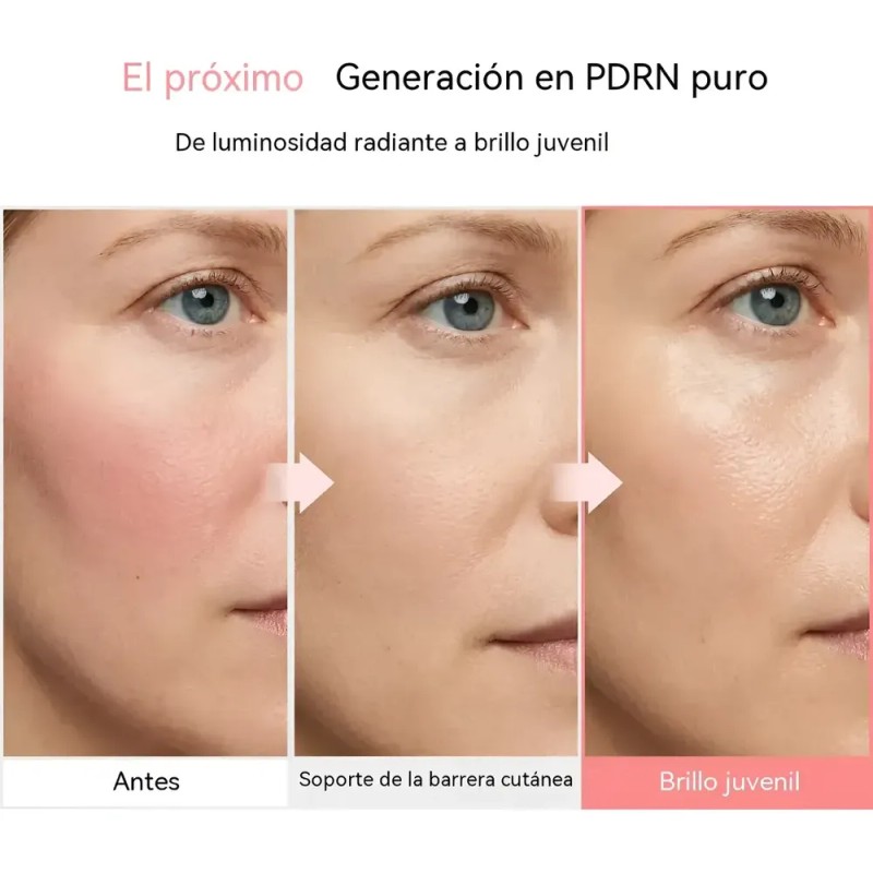 Ampolla De Colágeno Profundo 30ml - Péptido De Colágeno Para