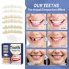 Tooth Repair Kit，Temporary Natural Shade for Filling The Gap