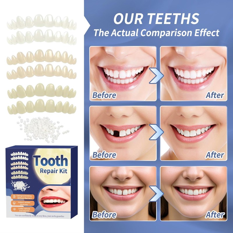 Tooth Repair Kit，Temporary Natural Shade for Filling The Gap