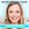 Tiras Blanqueadoras Dientes Sensibles Piezas Kit Completo Fácil Usar Resultados