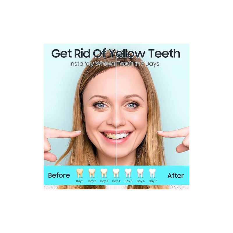 Tiras Blanqueadoras Dientes Sensibles Piezas Kit Completo Fácil Usar Resultados