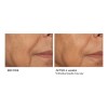 Suero De Biopéptido De Niacinamida Nassifmd Skincare
