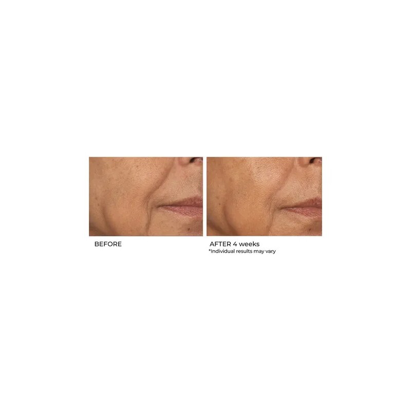 Suero De Biopéptido De Niacinamida Nassifmd Skincare