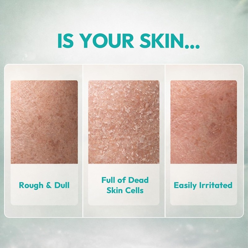 Exome Exorra 4X Active Gel AHA BHA PHA LHA Peeling