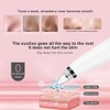Electric Blackhead Removal Machine Vacuum Suction Oil Control Pore Cleaner