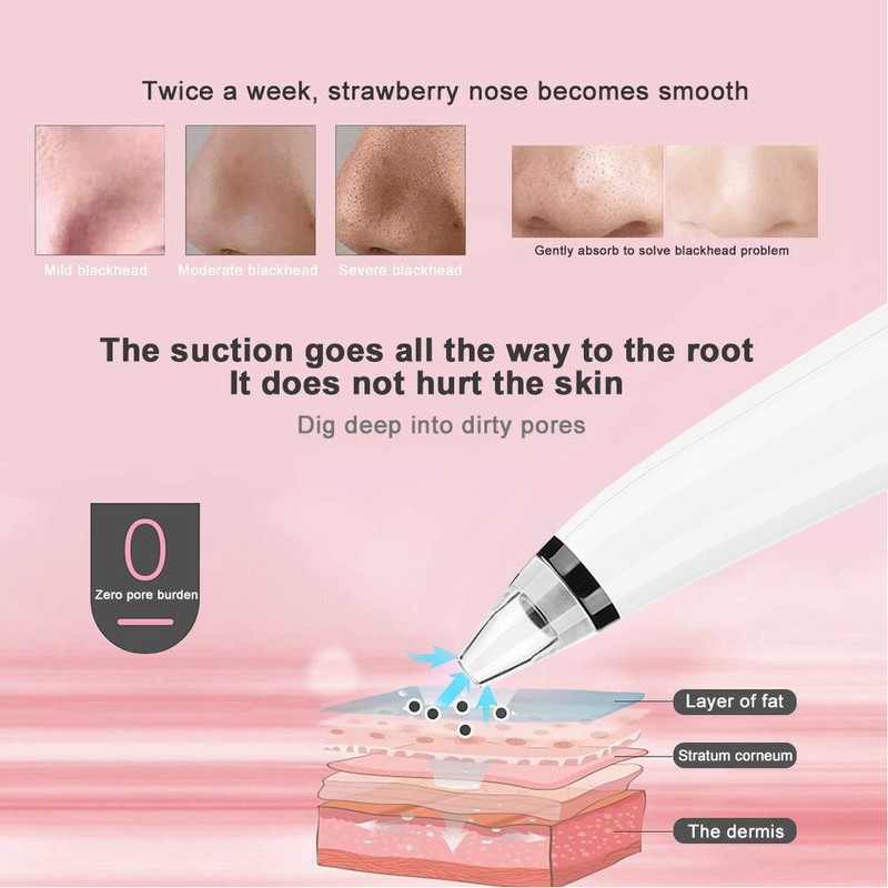 Electric Blackhead Removal Machine Vacuum Suction Oil Control Pore Cleaner