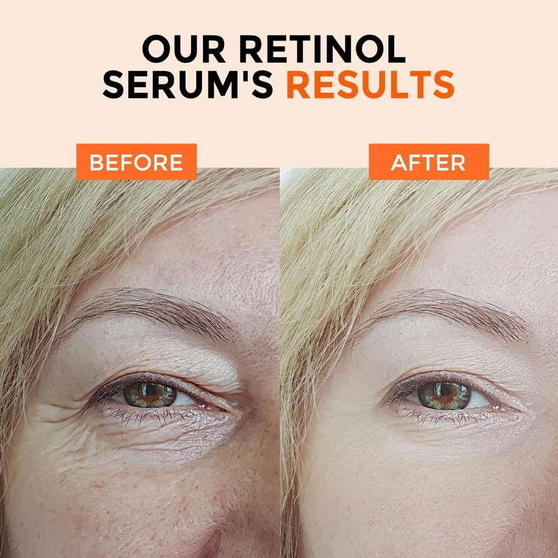 +1HEROLABS 1 Fl Oz Retinol Serum with Vitamin C and
