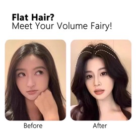 BIDEX 2PCS Hair Volume Clip for Bangs Styling – No-Trace Hair Root Lifting Clips for Fluffy Bangs & Voluminous Hair – Quick & Easy Hair Styling Tools for All Hair Types (Blue)