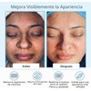 Glycolic Acid 50% Gel Peel - Enhanced with Retinol &