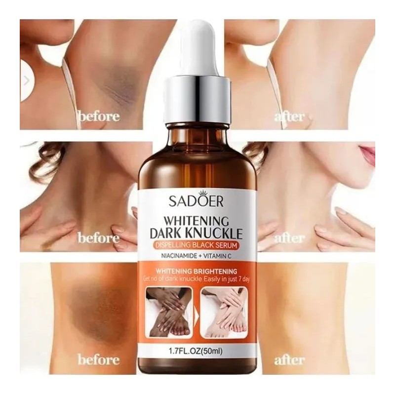 Serum Blanqueador Axilas Zonas Intimas Codos Rodillas 50ml Todo Tipo