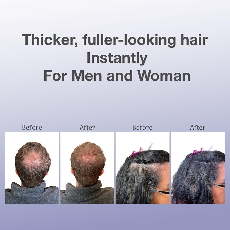 Bosley Professional Strength Hair Thickening Fibers