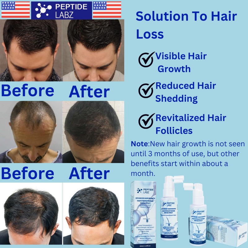 Peptide Labz Hair Growth Serum Spray with Acetyl Tetrapeptide-3