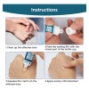 Crema Para Eliminar Cicatrices, Gel Avanzado Para Cicatrices
