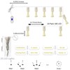 DINOWIN Mini Firework String Light with Remote Control USB Operated