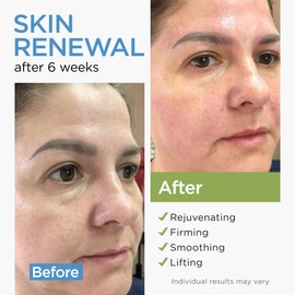 Collagen Cream for Face with Stem Cells Retinol Hyaluronic Acid Niacinamide for All Skin Types - Anti-Aging Face Moisturizer with Airless Pump - Day & Night Cream for Wrinkles - Made in USA 1.7 Oz