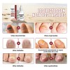 Tratamiento Para Uñas 15 Ml X2 Solución Para Cuidado De