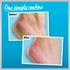 O'Keeffe's Healthy Feet 80ml & Healthy Feet Exfoliating 80ml (Twin