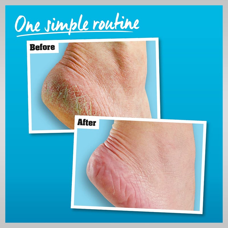 O'Keeffe's Healthy Feet 80ml & Healthy Feet Exfoliating 80ml (Twin