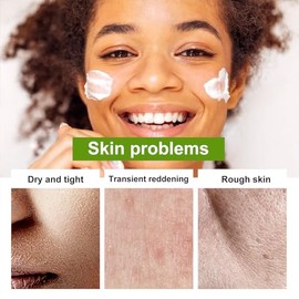 Grospe Crema facial hidratante de aloe vera, crema facial con 98% de aloe vera orgánico, crema hidratante facial antiarrugas, para piel seca, cicatric