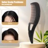 LOPHE Dandruff Comb, Pack of 2 Scalp Comb, Birth Comb