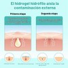 180 Pcs Parches para Granos, Parches Granos Estrella, Con Aceite