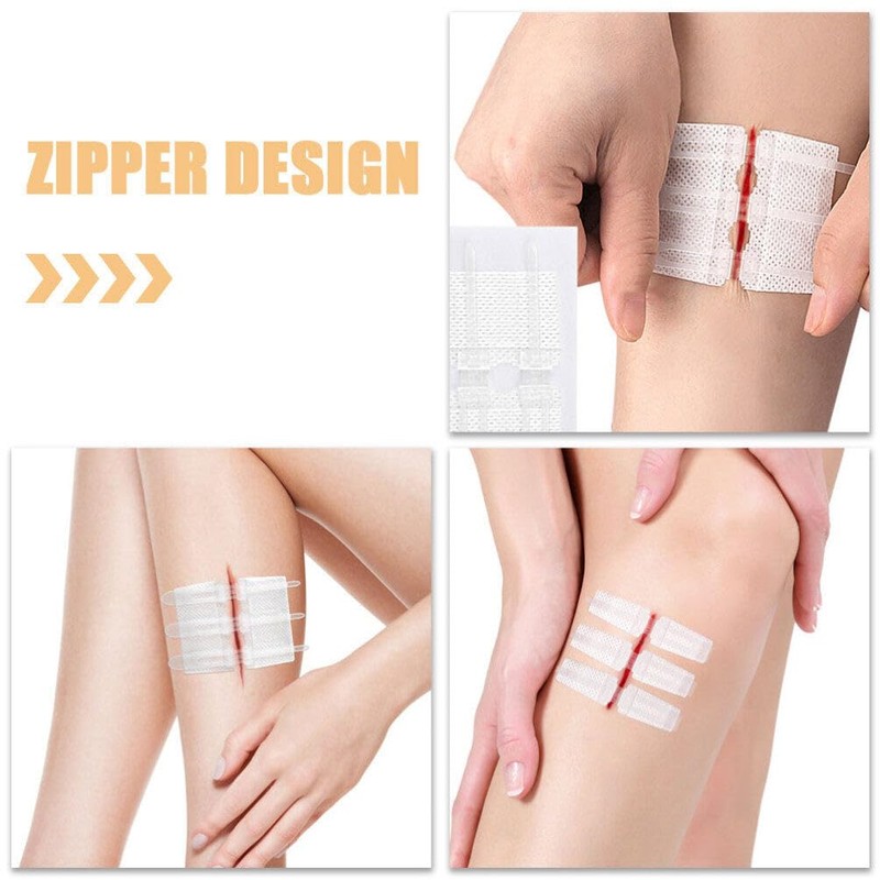 Beavorty 1 Set Zip Stitch with Wound Dresssings WoundClosure Strips