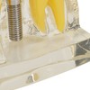 Teeth Implant Model Transparent Dental Teaching Research Demonstration Teeth Model