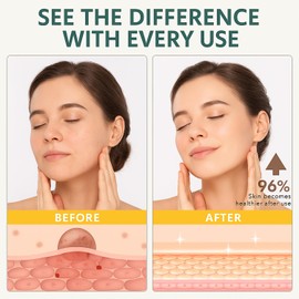 Grass-Fed Tallow Balm with Honey & Beeswax Deep Moisturizing Face & Body Cream Non-Comedogenic, Fragrance-Free For Dry Sensitive Skin Calms Redness 4.2 oz