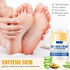 Crema Hidratante y Alivia el Grietas y Sequedad para Pies,