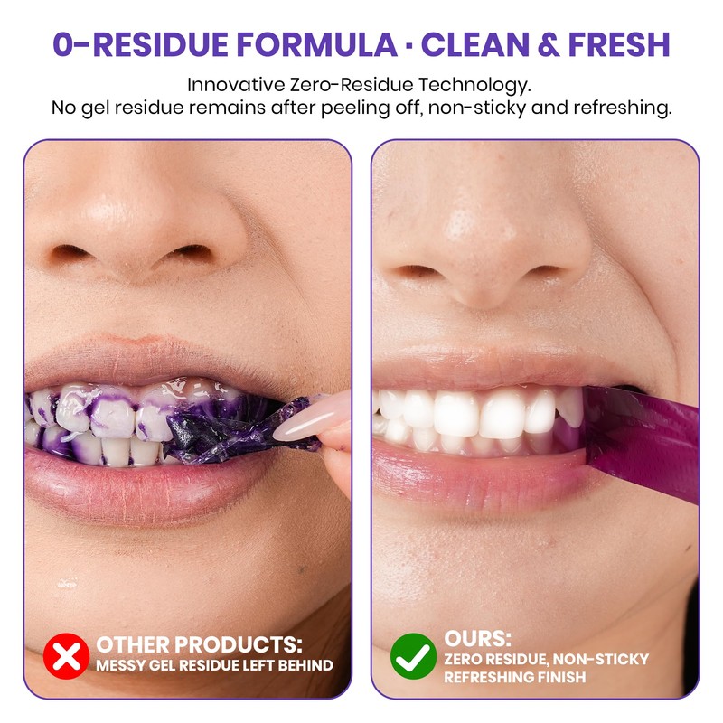 28 Strips | Purple Teeth Whitening Strips | Professional Teeth