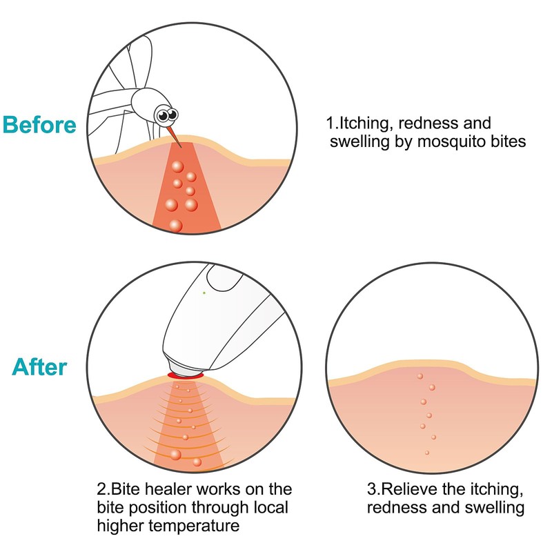 MYCARBON Insect Sting and Bite Relief
