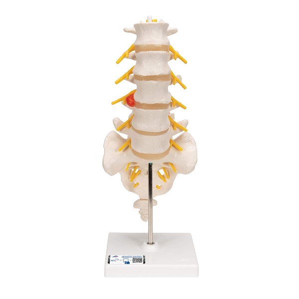 Movable lumbar model with herniated spinal discs, and horses can be observed - Lumbar model (with herniated herniation) - 3B Scientific
