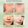 Kit Skincare Aguacate 7pz Tonico Suero Limpiador Balsamo Loc