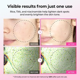 Dr.Melaxin Bright & Smooth Skincare Total Care Set – Glow, Pore Refinement & Spot Treatment, Korean Skincare