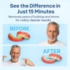 iSonic F3900 Ultrasonic Cleaner for Dentures, Retainers, and Mouth Guards,