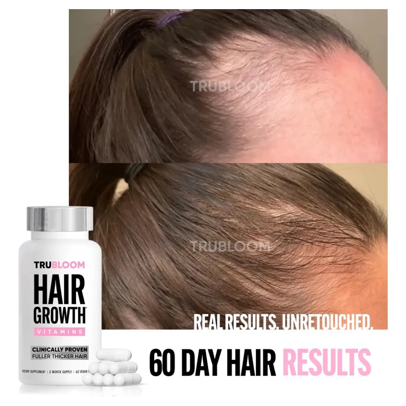 Vitaminas Crecimiento Cabello Tru Bloom