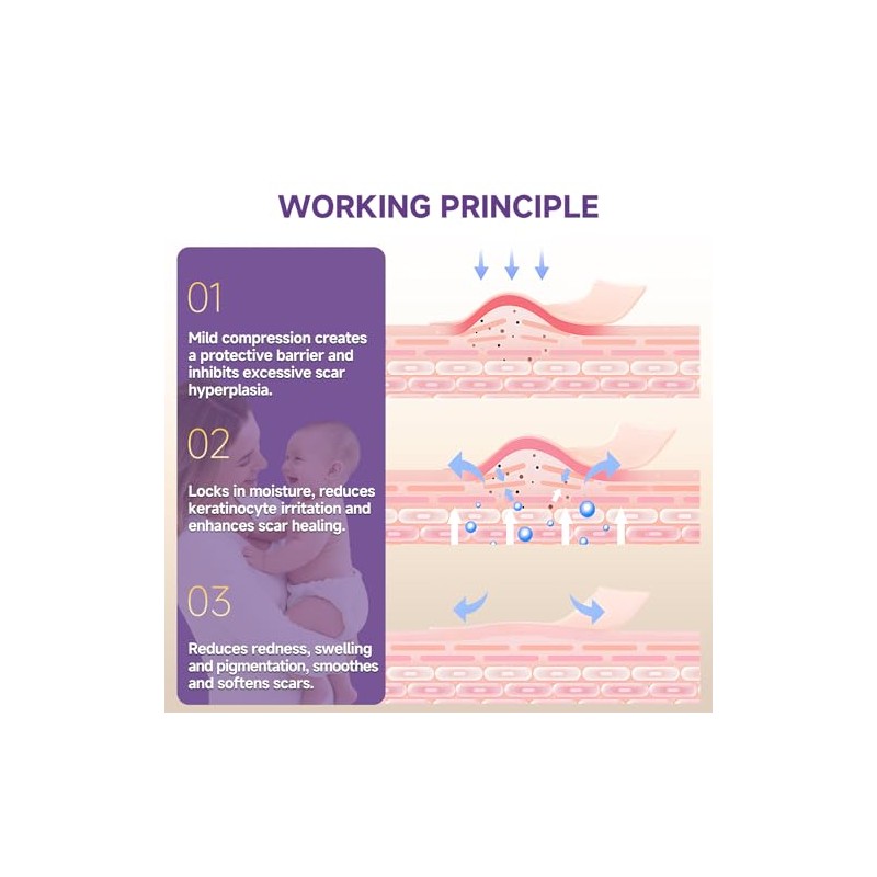 Reusable Silicone Scar Tape for Effective Scar Treatment