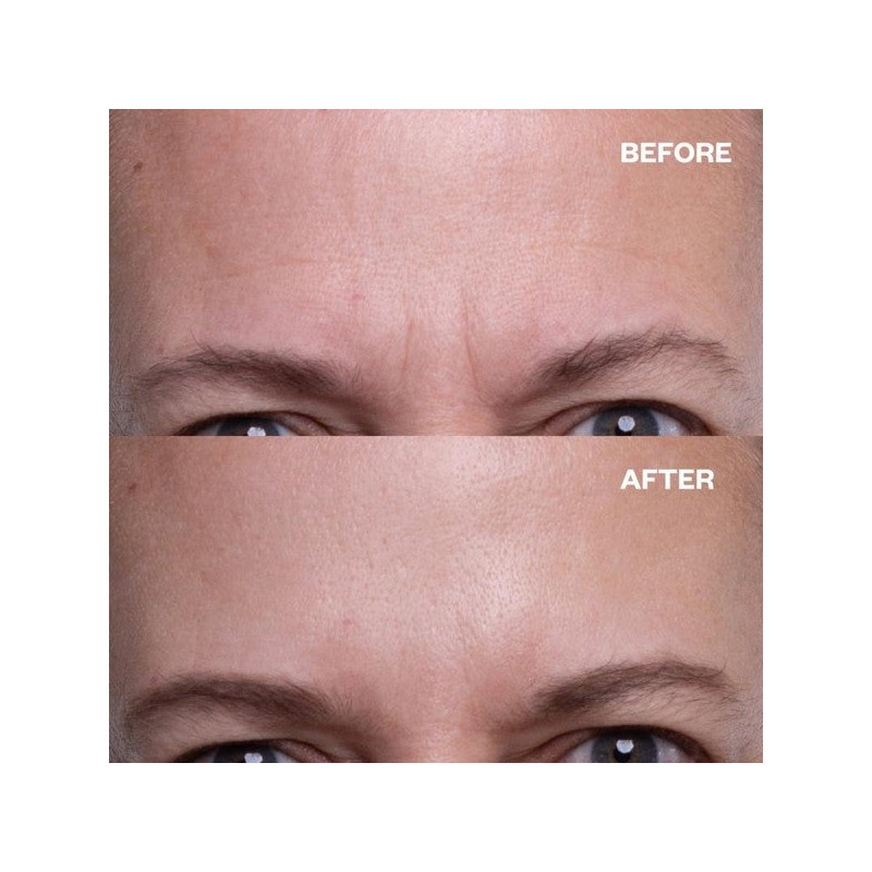 Wrinkles Schminkles Forehead Wrinkle Patches - 2 Patches