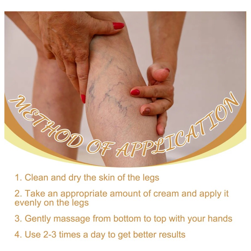 Crema Para Venas Varicosas,alivia Dolor Y Eliminar Varices*2