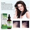 NIFEISHI Rosemary Oil for Hair Growth, 100% Pure Organic Rosemary