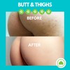 Butt Acne Clearing Lotion (2 pack) for back, buttocks, &