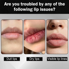 Jutqut 2 PCS Lip Balm for Dark Lips, Hydrating Moisturizing Dark Lips Corrector for Smokers, Help Fade Lip Discoloration & Fine Lines, Long-Lasting Moisturizer for Men & Women