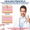 Wound Closure Strips - Emergency Laceration Closure Kit to Repair