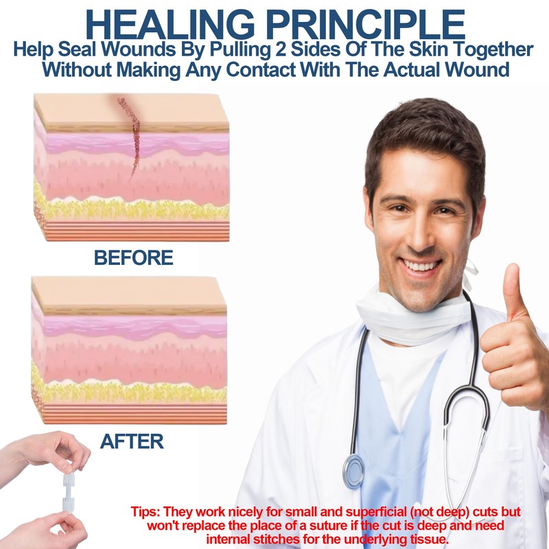 Wound Closure Strips - Emergency Laceration Closure Kit to Repair