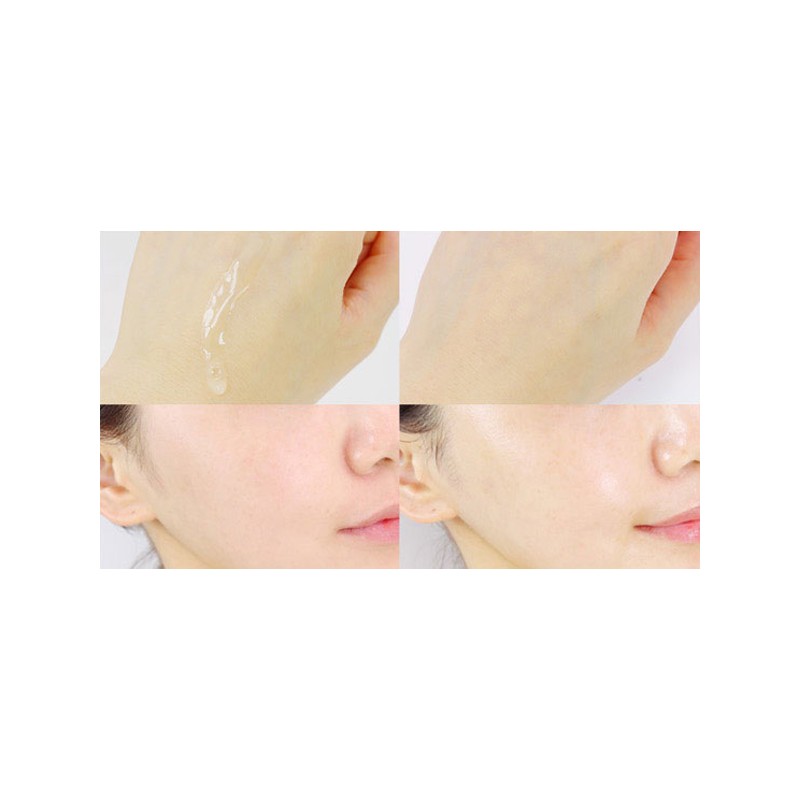 Acnes Dermarelief Balancing Skin, 200ml, 1 piece