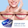 iZhuoKe 28 Pieces Teeth Whitening Strips,Teeth Whitening,Professional Teeth Stain Removal,Whiten