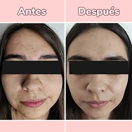 Super Serum 4 en 1 - Vitamina C + Ácido Hialurónico + Vitamina E + Niacinamida | - Para Todo Tipo de Piel - Suero Facial Antiarrugas y Manchas Para Il