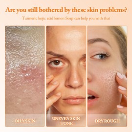 Turmeric Kojic Acid Soap Lemon Soap, Kojic Acid Soap original, Turmeric Soap für Gesicht und Körper, Zitronen-Kurkuma-Kojisäure-Seife für Dunkle Flecken (2 Stücke）